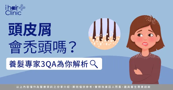 頭皮屑會禿頭嗎-頭皮屑 禿頭