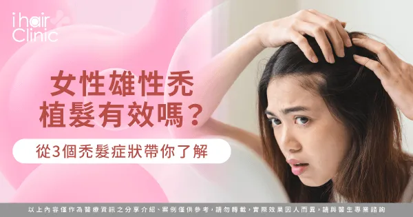  3個雄性禿髮症狀分析女性植髮優點-女性雄性禿 植髮