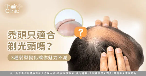 禿頭適合的3種髮型變化全解析-禿頭 剃光頭