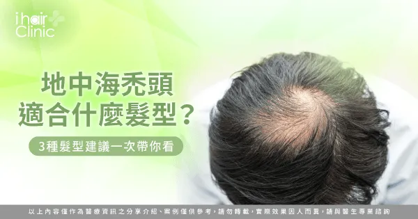 地中海禿頭適合的3個髮型設計-地中海禿頭 髮型