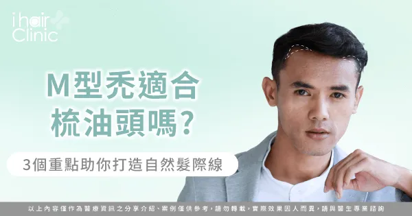 3個重點解析M型禿適不適合梳油頭-M型禿 油頭