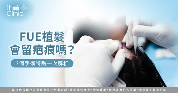 3個重點解析FUE植髮是否會留疤-FUE 植髮 疤痕