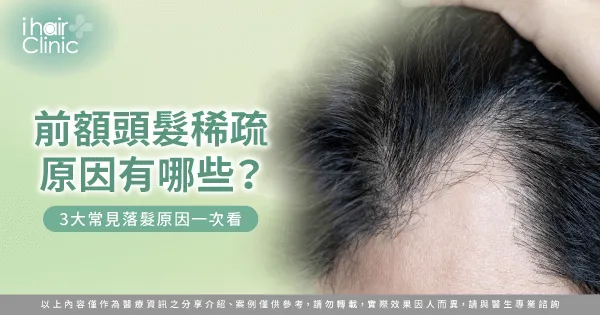 前額頭髮稀疏3大原因一次看-前額頭髮稀疏