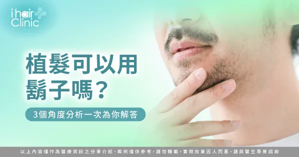 用鬍子植髮的3個角度解析一次看-植髮可以用鬍子嗎