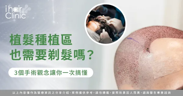 3個觀念解析植髮種植區是否要剃髮-植髮 種植 區