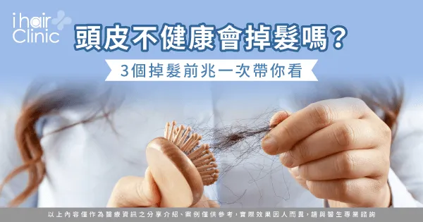 3個重點解析頭皮不健康對頭髮的影響-頭皮不健康 掉髮