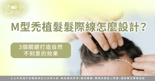 M型禿 植髮 髮際線設計-植髮 髮際線 自然