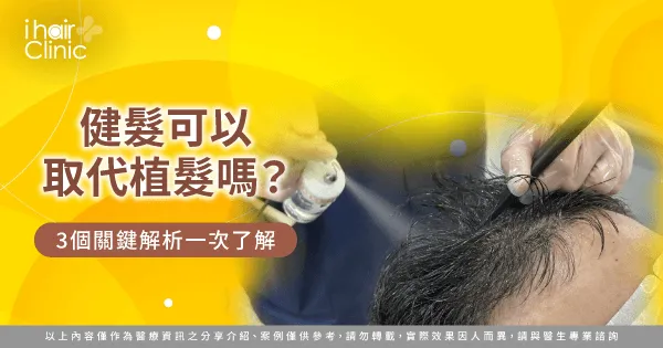 健髮 可以取代植髮嗎-健髮 植髮 差別