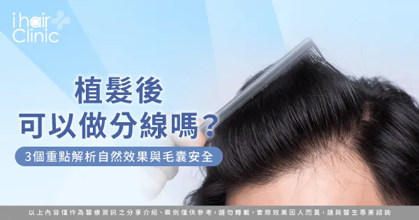 植髮後可以做分線嗎-植髮 分線