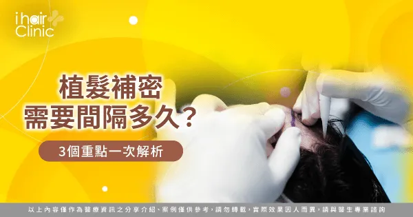 植髮補密需要間隔多久-植髮 補密 多久