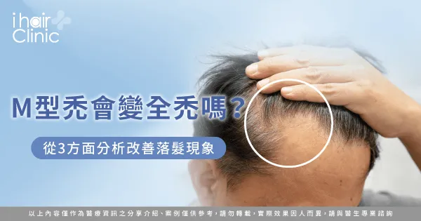 M型禿會 全禿-M型禿會 變嚴重