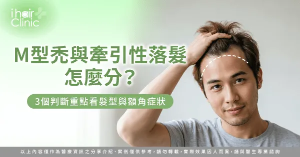 M型禿 牽引性落髮差別-M型禿 牽引性落髮