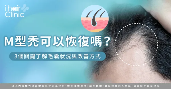 M型禿可以恢復嗎-M型禿恢復