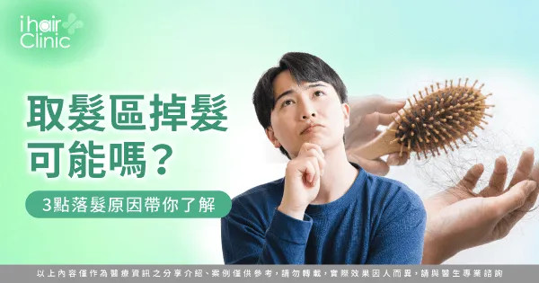 3重點解析取髮區掉髮的的詳細原因-取髮區 掉髮