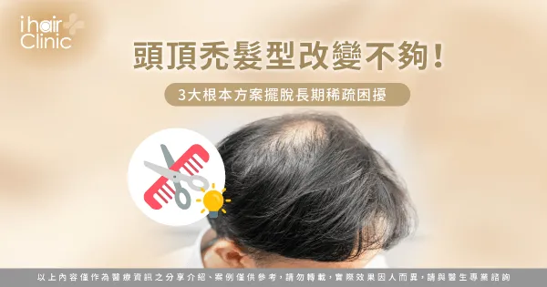 頭頂禿髮型-頭頂稀疏髮型