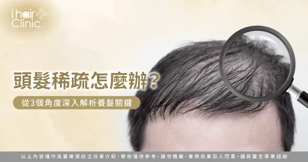頭髮稀疏改善3大關鍵全解析-頭髮稀疏怎麼辦