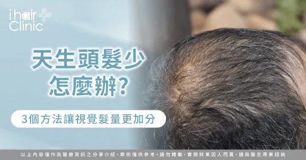 天生頭髮少的3個解決方法一次看-天生頭髮少怎麼辦