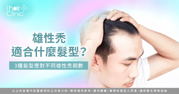 雄性禿適合的3種髮型不藏私分享-雄性禿適合什麼髮型