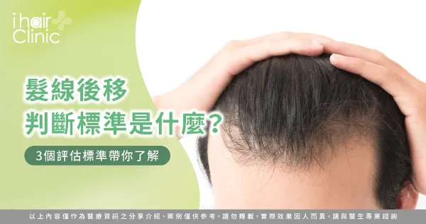  髮線後移3個判斷方法全解析-髮線後移判斷