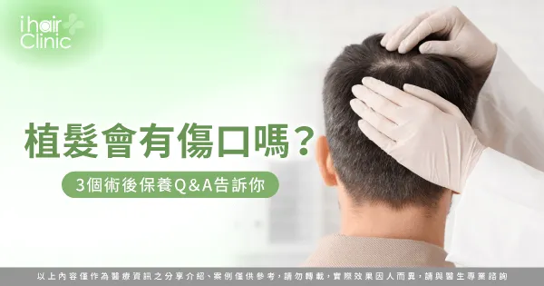 植髮後養護傷口的3大重點全解析-植髮 會 有 傷口 嗎