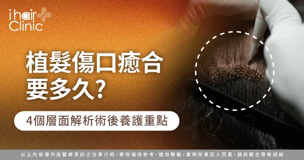  加速植髮傷口癒合要注意的4個重點-植髮 傷口癒合