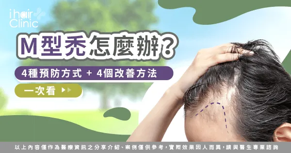  M型禿的預防及改善方法-M型禿 改善
