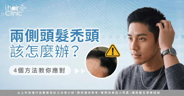  頭髮兩側禿頭-兩側頭髮稀疏