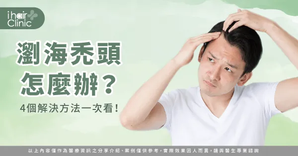 4個瀏海禿的改善方法-瀏海禿頭怎麼辦