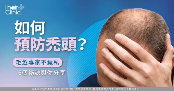 如何預防禿頭-如何防止禿頭