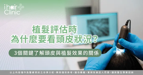 植髮評估時為什麼要看頭皮狀況-植髮頭皮 狀況