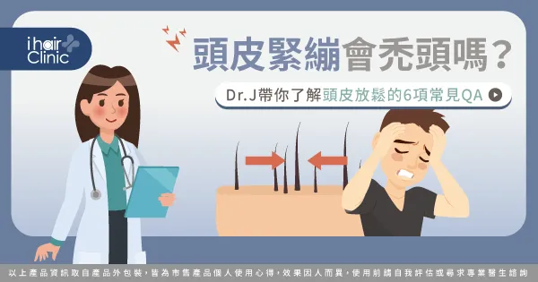 頭皮緊繃會禿頭嗎-頭皮緊繃