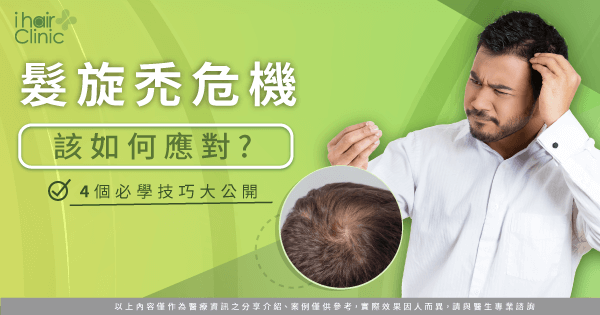 髮旋禿怎麼辦-髮旋禿植髮