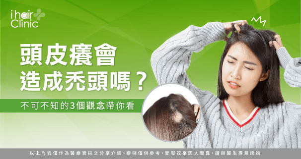 頭皮癢會禿頭嗎-植髮頭皮癢