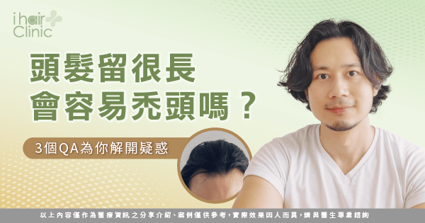 頭髮太長會禿頭嗎-頭髮長禿頭