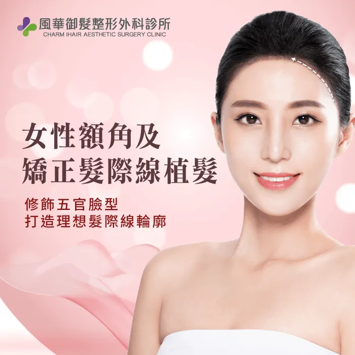 女性髮際線植髮-髮際線植髮推薦