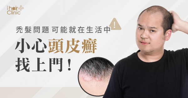 頭皮癬禿頭-新竹植髮診所推薦