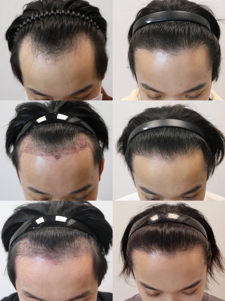 雞**** 評論照片