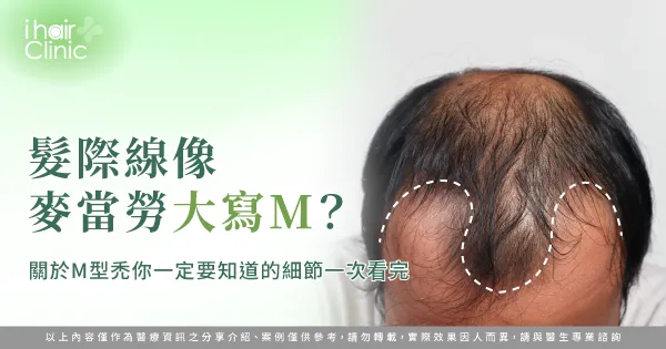 新竹M型禿-新竹M型禿植髮推薦