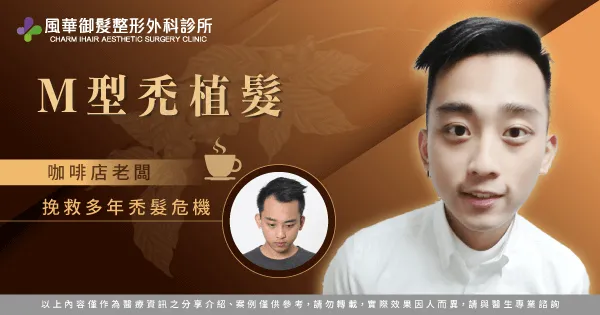 咖啡店老闆群群M型禿植髮-新竹植髮推薦