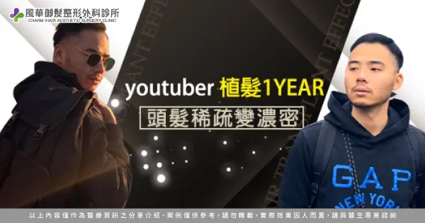 頭髮稀疏變濃密-新竹植髮推薦