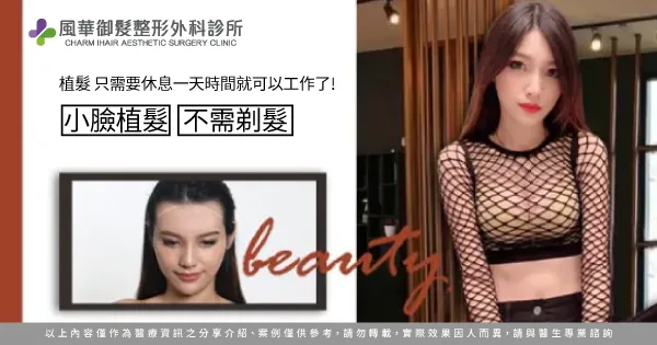 髮際線植髮-新竹植髮推薦