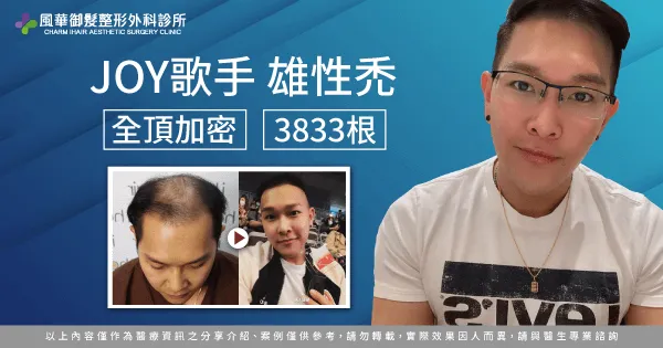 雄性禿植髮-新竹植髮推薦