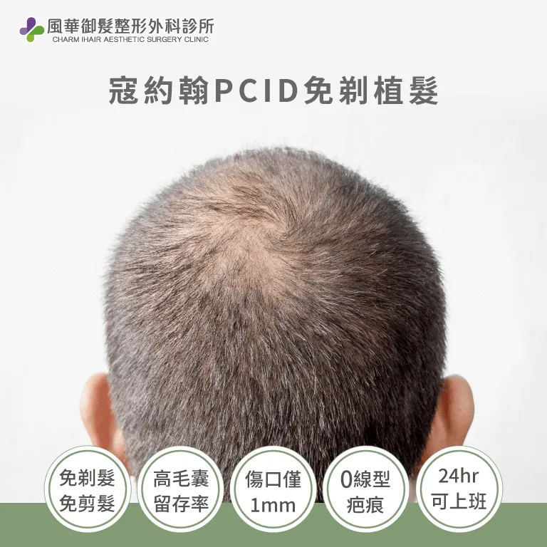 寇約翰植髮-新竹植髮推薦