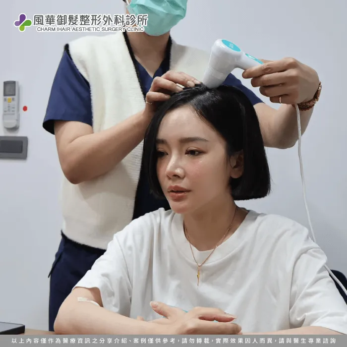 女性植髮際線-新竹女性植髮推薦