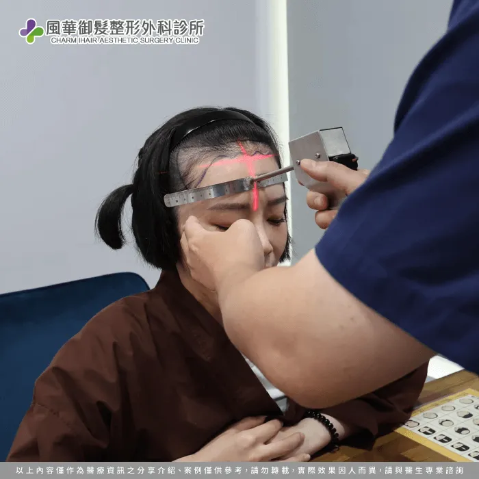 實際測量植髮範圍比例-新竹女性植髮推薦