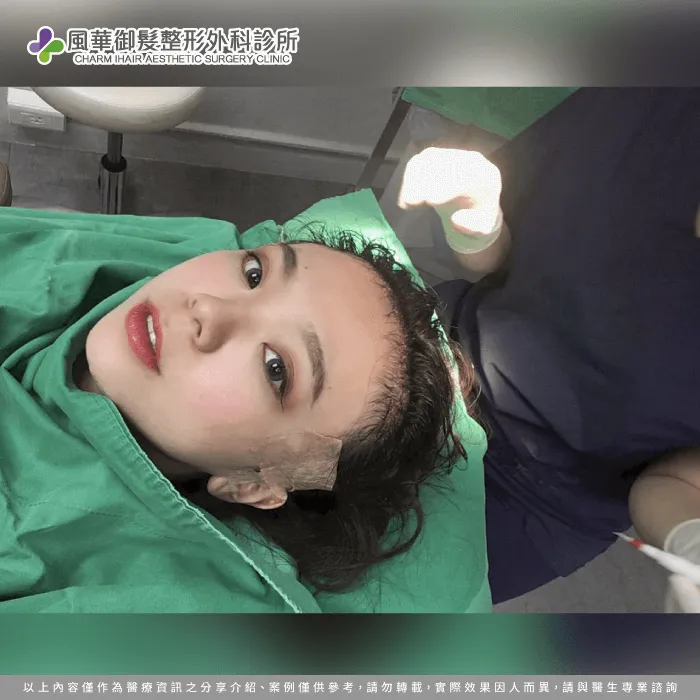 頭皮檢測過程-女性植髮