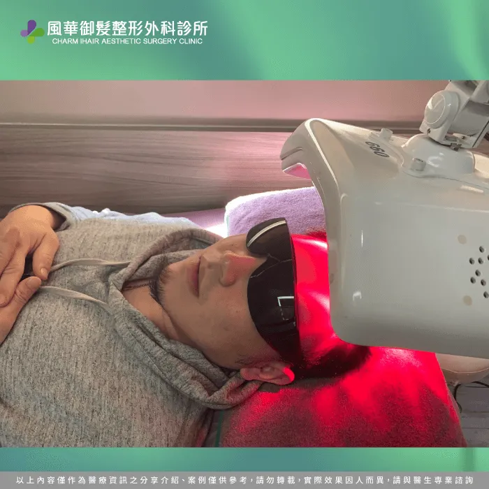植髮後頭皮養護-新竹植髮推薦