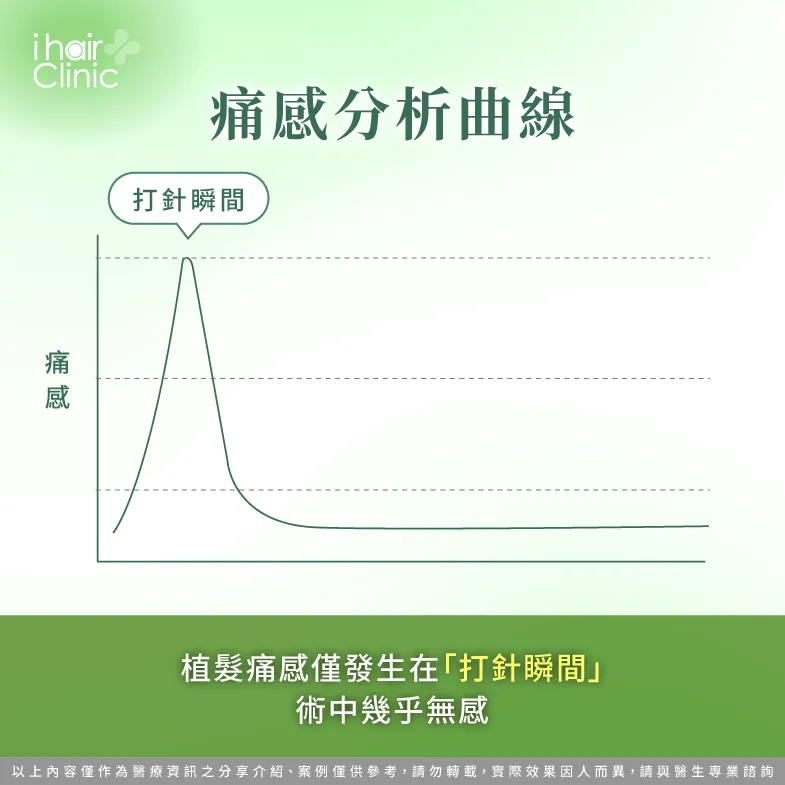 植髮痛感僅發生在打針瞬間,術中幾乎無感 植髮痛感分析曲線-植髮會痛嗎