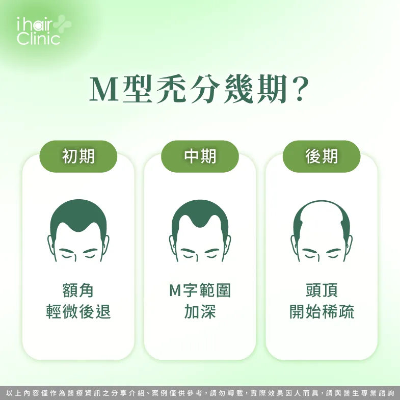 M型禿分幾期?掉髮進程與變化解析 M型禿分期-M型禿植髮診所