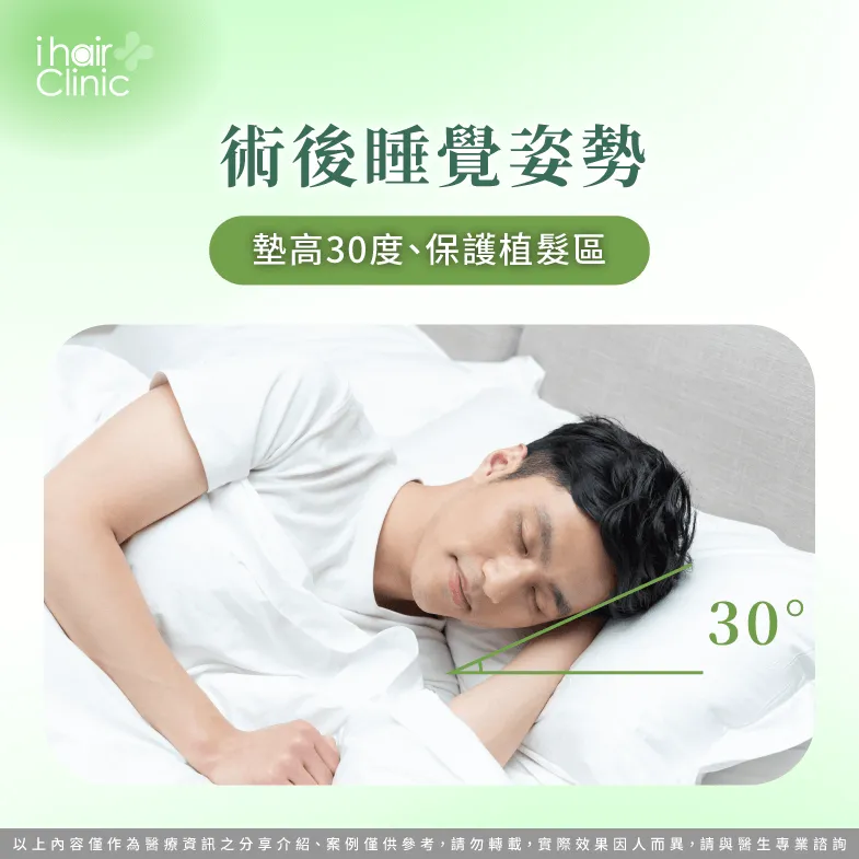 術後睡覺姿勢:墊高30度、保護植髮區 術後睡眠姿勢建議-植髮保養